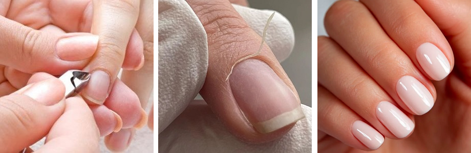 Cuticle care